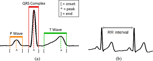 Figure 2 for Time series kernel similarities for predicting Paroxysmal Atrial Fibrillation from ECGs
