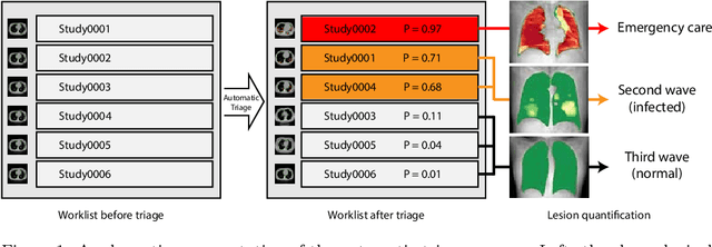 Figure 1 for CT-based COVID-19 Triage: Deep Multitask Learning Improves Joint Identification and Severity Quantification