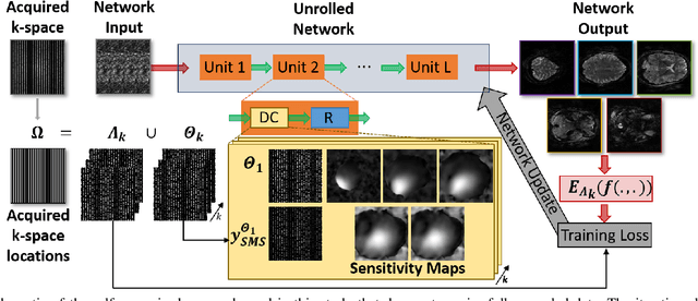 Figure 1 for 20-fold Accelerated 7T fMRI Using Referenceless Self-Supervised Deep Learning Reconstruction