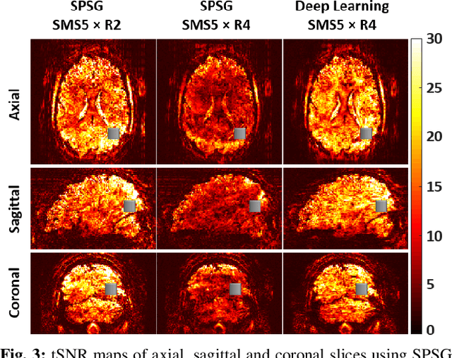 Figure 3 for 20-fold Accelerated 7T fMRI Using Referenceless Self-Supervised Deep Learning Reconstruction