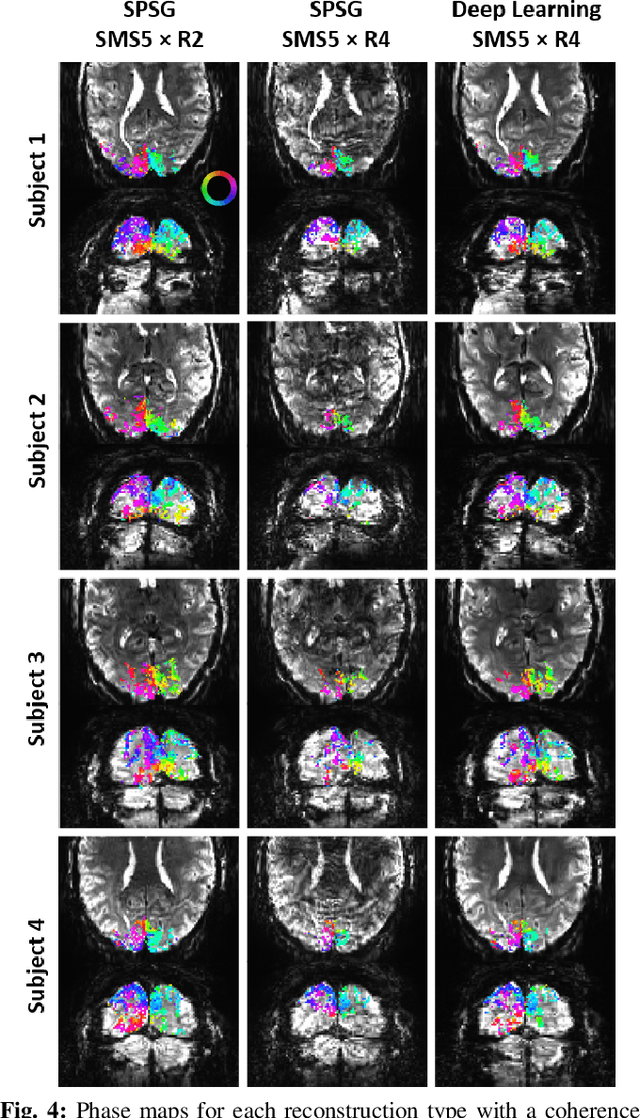 Figure 4 for 20-fold Accelerated 7T fMRI Using Referenceless Self-Supervised Deep Learning Reconstruction