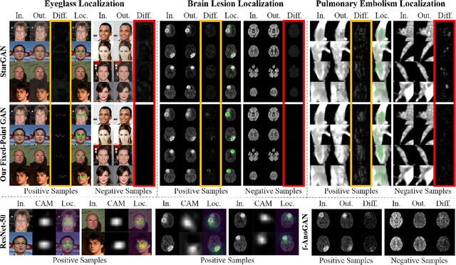 Figure 1 for Learning Fixed Points in Generative Adversarial Networks: From Image-to-Image Translation to Disease Detection and Localization