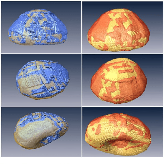 Figure 2 for 3D Ultrasound image segmentation: A Survey