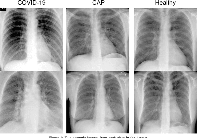 Figure 1 for Intra-model Variability in COVID-19 Classification Using Chest X-ray Images