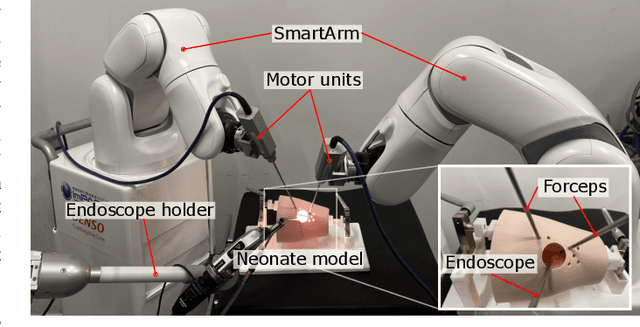 Figure 1 for SmartArm: Suturing Feasibility of a Surgical Robotic System on a Neonatal Chest Model