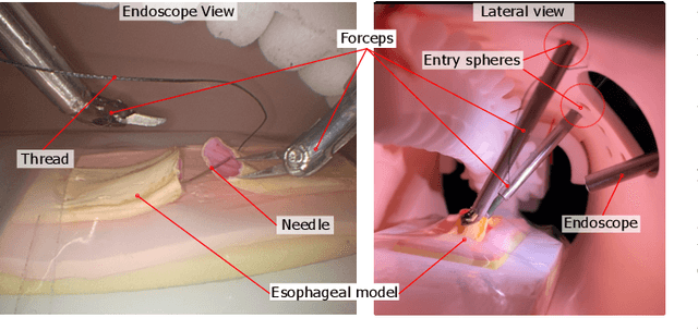 Figure 2 for SmartArm: Suturing Feasibility of a Surgical Robotic System on a Neonatal Chest Model