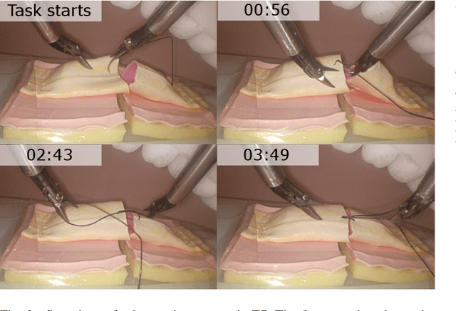 Figure 3 for SmartArm: Suturing Feasibility of a Surgical Robotic System on a Neonatal Chest Model
