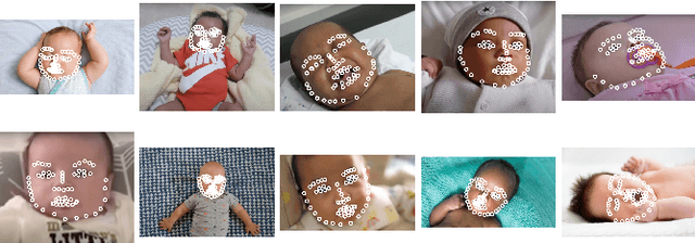 Figure 1 for InfAnFace: Bridging the infant-adult domain gap in facial landmark estimation in the wild