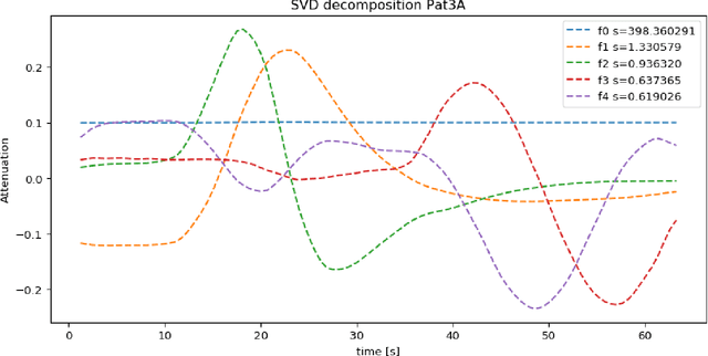 Figure 1 for Noise and dose reduction in CT brain perfusion acquisition by projecting time attenuation curves onto lower dimensional spaces