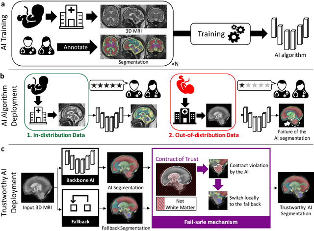 Figure 1 for A Dempster-Shafer approach to trustworthy AI with application to fetal brain MRI segmentation