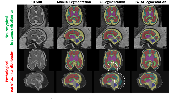 Figure 3 for A Dempster-Shafer approach to trustworthy AI with application to fetal brain MRI segmentation
