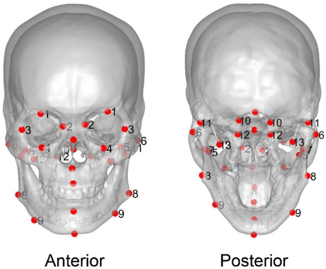 Figure 4 for Transfer Learning from an Artificial Radiograph-landmark Dataset for Registration of the Anatomic Skull Model to Dual Fluoroscopic X-ray Images