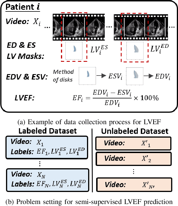 Figure 1 for Cyclical Self-Supervision for Semi-Supervised Ejection Fraction Prediction from Echocardiogram Videos