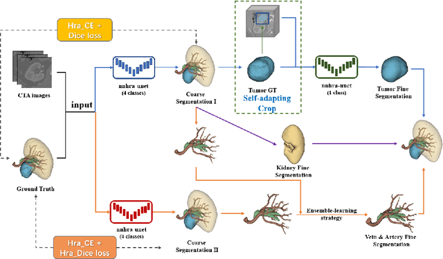 Figure 1 for A Multi-Stage Framework for the 2022 Multi-Structure Segmentation for Renal Cancer Treatment