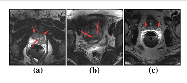 Figure 1 for Selective Information Passing for MR/CT Image Segmentation