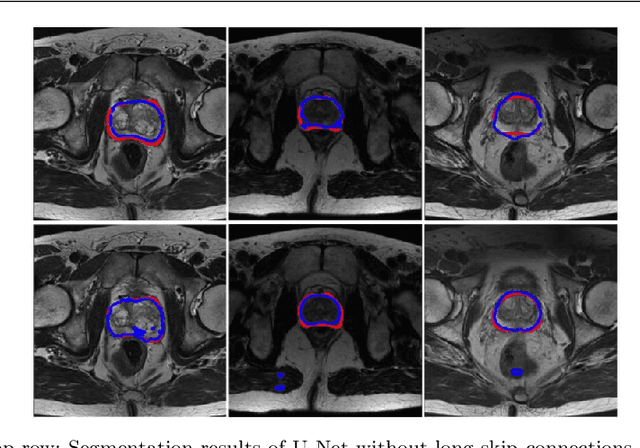 Figure 3 for Selective Information Passing for MR/CT Image Segmentation