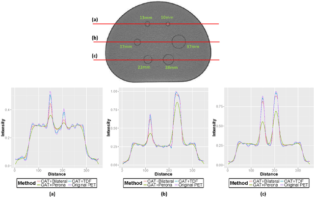 Figure 3 for Optimally Stabilized PET Image Denoising Using Trilateral Filtering