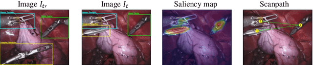 Figure 4 for Learning Where to Look While Tracking Instruments in Robot-assisted Surgery