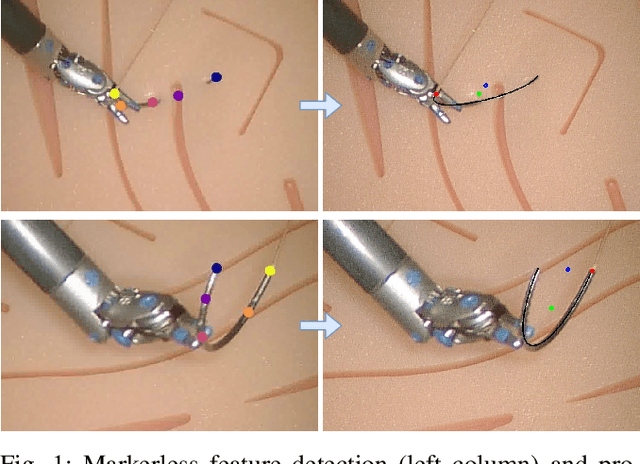 Figure 1 for Markerless Suture Needle 6D Pose Tracking with Robust Uncertainty Estimation for Autonomous Minimally Invasive Robotic Surgery