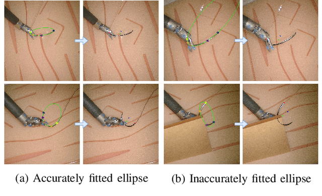 Figure 4 for Markerless Suture Needle 6D Pose Tracking with Robust Uncertainty Estimation for Autonomous Minimally Invasive Robotic Surgery