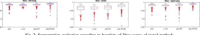 Figure 2 for Image to Images Translation for Multi-Task Organ Segmentation and Bone Suppression in Chest X-Ray Radiography