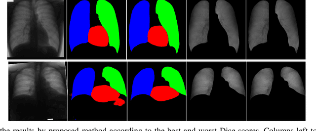 Figure 4 for Image to Images Translation for Multi-Task Organ Segmentation and Bone Suppression in Chest X-Ray Radiography