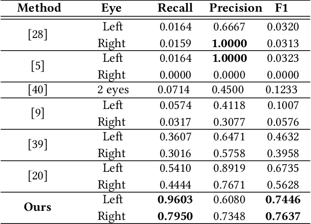 Figure 4 for mEBAL: A Multimodal Database for Eye Blink Detection and Attention Level Estimation