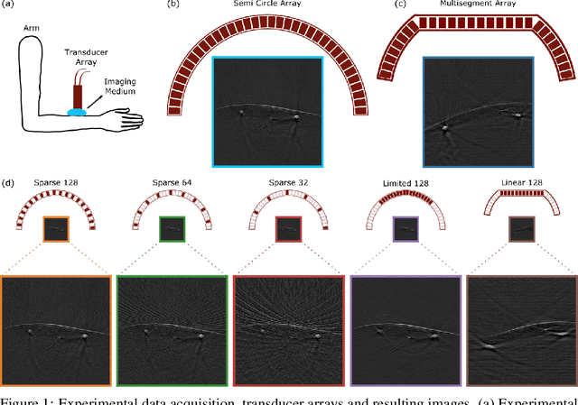 Figure 1 for OADAT: Experimental and Synthetic Clinical Optoacoustic Data for Standardized Image Processing