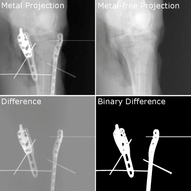 Figure 3 for View-Consistent Metal Segmentation in the Projection Domain for Metal Artifact Reduction in CBCT -- An Investigation of Potential Improvement