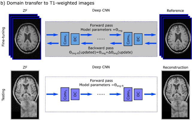 Figure 1 for A Transfer-Learning Approach for Accelerated MRI using Deep Neural Networks
