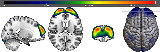 Figure 4 for Variational voxelwise rs-fMRI representation learning: Evaluation of sex, age, and neuropsychiatric signatures