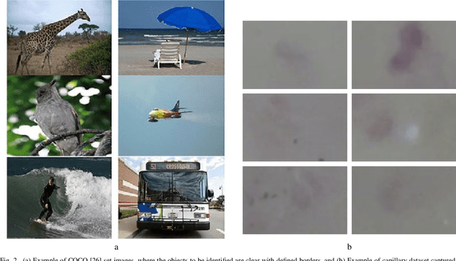 Figure 2 for Deep Learning and Computer Vision Techniques for Microcirculation Analysis: A Review