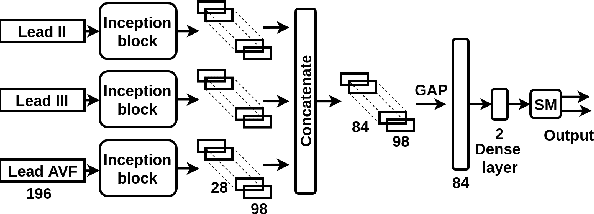 Figure 1 for Detection of Inferior Myocardial Infarction using Shallow Convolutional Neural Networks