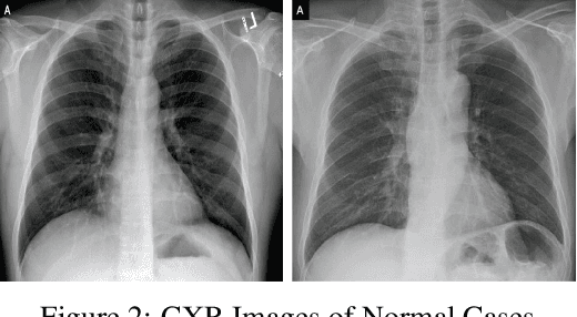 Figure 2 for Fused Deep Convolutional Neural Network for Precision Diagnosis of COVID-19 Using Chest X-Ray Images