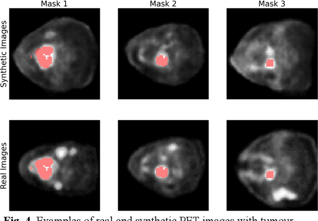 Figure 4 for Assessing Privacy Leakage in Synthetic 3-D PET Imaging using Transversal GAN