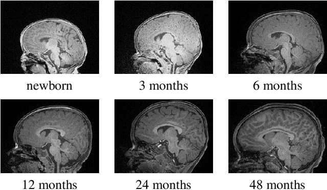 Figure 1 for FRNET: Flattened Residual Network for Infant MRI Skull Stripping