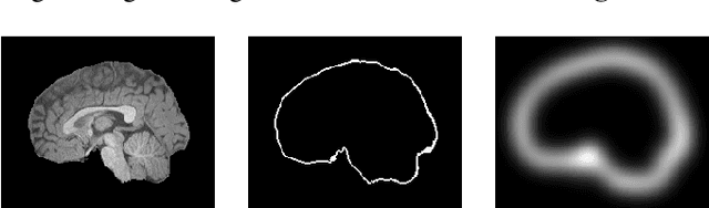 Figure 4 for FRNET: Flattened Residual Network for Infant MRI Skull Stripping