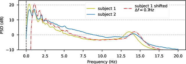 Figure 1 for Data augmentation for learning predictive models on EEG: a systematic comparison