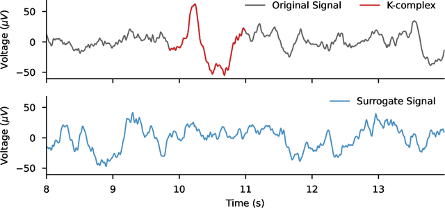 Figure 3 for Data augmentation for learning predictive models on EEG: a systematic comparison