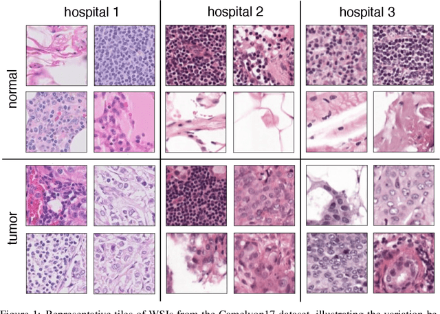 Figure 1 for Uncertainty estimation for out-of-distribution detection in computational histopathology