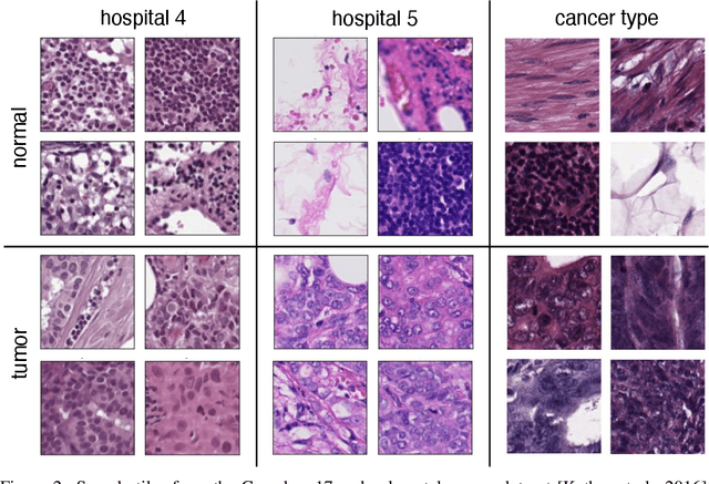 Figure 3 for Uncertainty estimation for out-of-distribution detection in computational histopathology