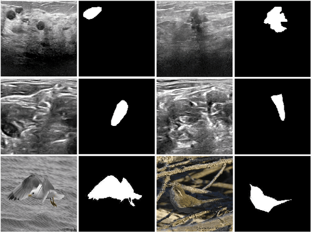 Figure 1 for Adaptive Neural Layer for Globally Filtered Segmentation