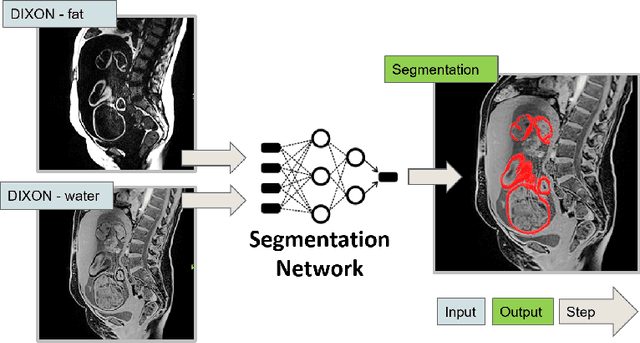 Figure 3 for Automatic fetal fat quantification from MRI