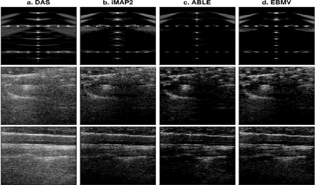 Figure 1 for Compressed Ultrasound Imaging:from Sub-Nyquist Rates to Super-Resolution