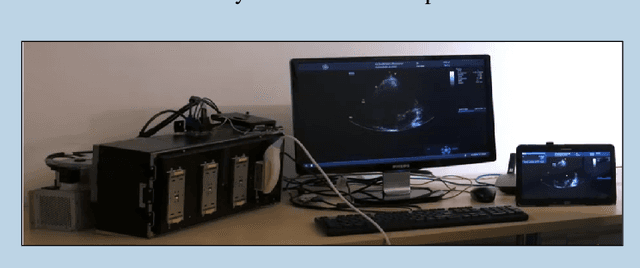 Figure 4 for Compressed Ultrasound Imaging:from Sub-Nyquist Rates to Super-Resolution