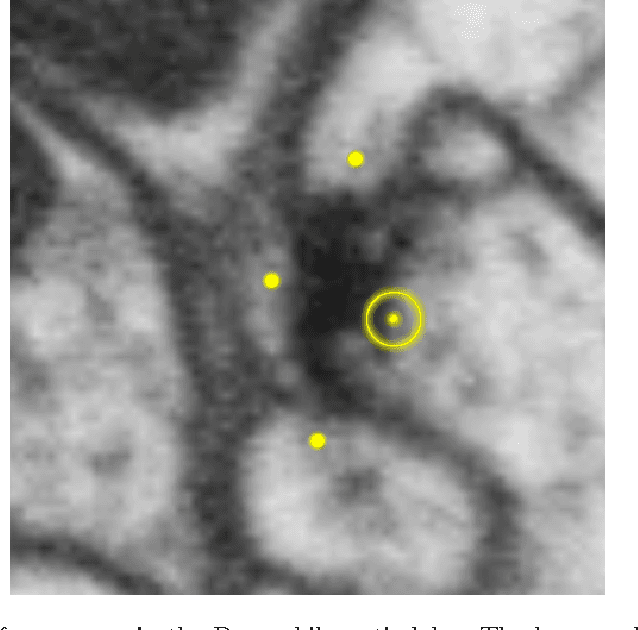 Figure 1 for Fully-Automatic Synapse Prediction and Validation on a Large Data Set