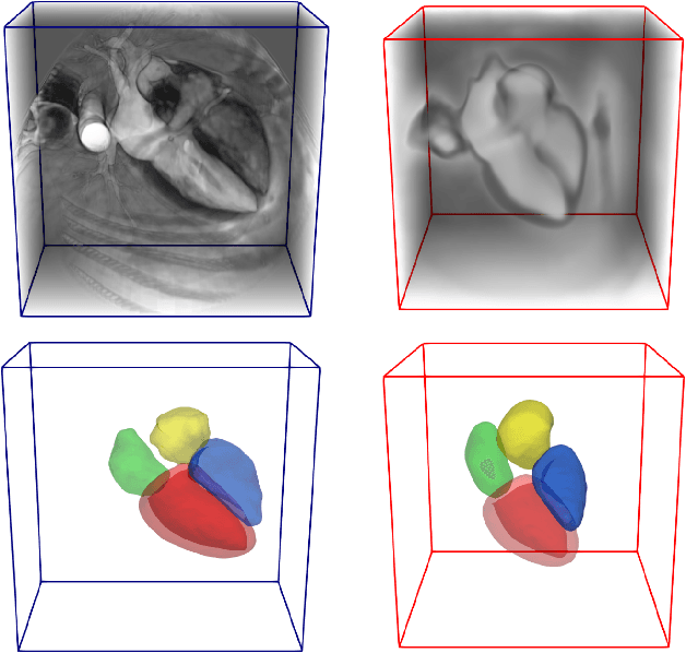 Figure 3 for Atlas-ISTN: Joint Segmentation, Registration and Atlas Construction with Image-and-Spatial Transformer Networks