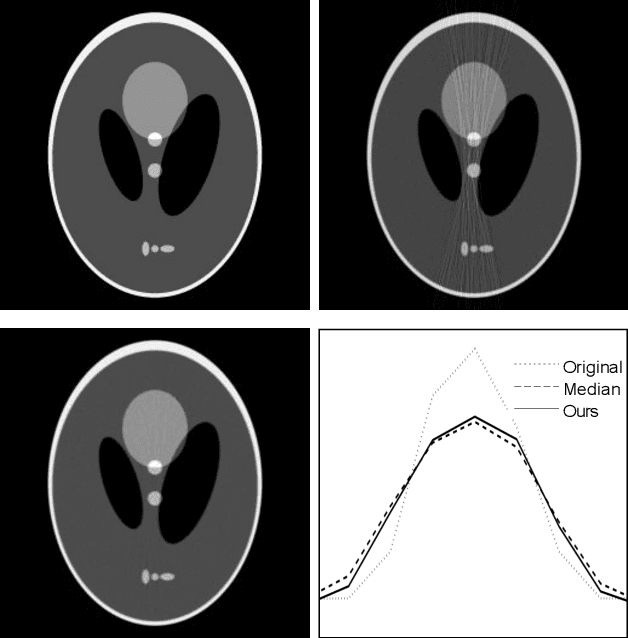 Figure 1 for Fast LLMMSE filter for low-dose CT imaging