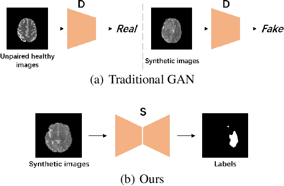 Figure 3 for Generator Versus Segmentor: Pseudo-healthy Synthesis