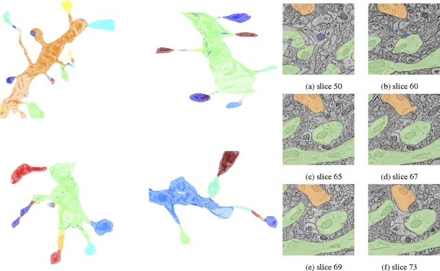 Figure 1 for SANTIAGO: Spine Association for Neuron Topology Improvement and Graph Optimization